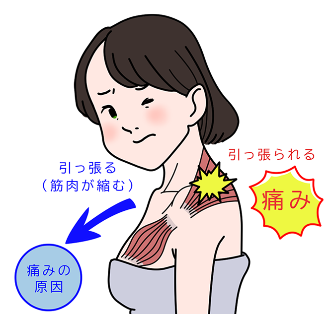 飯塚市 整体 筋肉の伸び縮みのイラスト